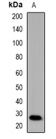Mannose Binding Protein Rabbit Polyclonal Antibody
