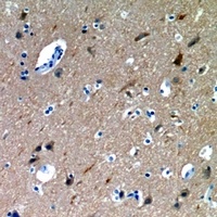 Mannose Binding Protein Rabbit Polyclonal Antibody