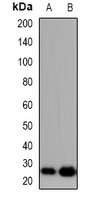 TIMP4 Rabbit Polyclonal Antibody