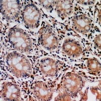 Anti-PIR121 Antibody