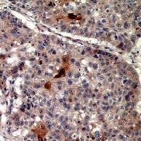 Anti-TRIF Antibody