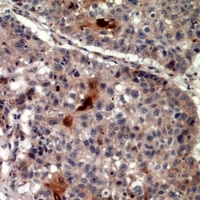 TICAM1 antibody