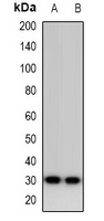Calsarcin 1 Rabbit Polyclonal Antibody