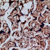 Anti-NOP56 Antibody