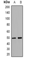 Endothelin B Receptor Rabbit Polyclonal Antibody