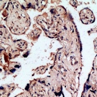 Anti-Endothelin B Receptor Antibody