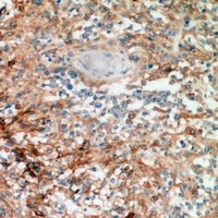 NANOS1 antibody