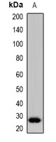 DCIR Rabbit Polyclonal Antibody
