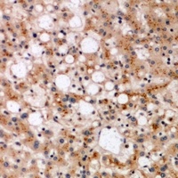 Anti-SPFH1 Antibody