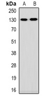 Collagen 1 alpha 1/2 Antibody