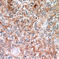 Anti-TRP2 Antibody