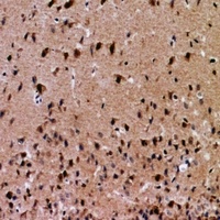 Anti-NFAT5 Antibody