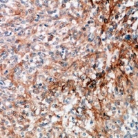 GRP78 Rabbit Polyclonal Antibody