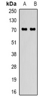 GADD34 Rabbit Polyclonal Antibody