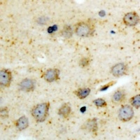 Anti-BID (Phospho-S78) Antibody