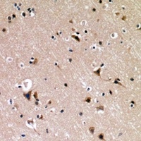 p53 (Phospho-S376) Antibody