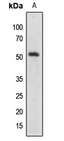 SMAD2/3 (Acetyl-K19) Rabbit Polyclonal Antibody