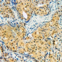 SMAD2/3 (Acetyl-K19) Rabbit Polyclonal Antibody