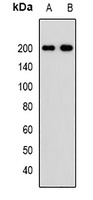 PDGFR beta Antibody