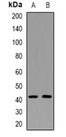Smooth Muscle Actin Rabbit Polyclonal Antibody