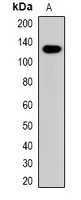 Collagen 4 alpha 1 Antibody