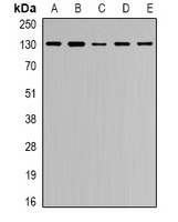 Collagen 4 alpha 1 Antibody