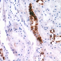 Anti-PTHR1 Antibody