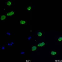 Anti-Beta-actin Antibody