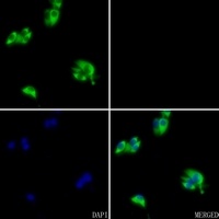 Anti-Complement C1R LC Antibody