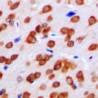 Anti-FPR1 Antibody