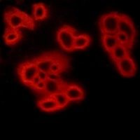 Anti-FPR1 Antibody