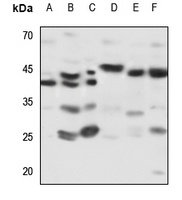 Kappa-actin Rabbit Polyclonal Antibody