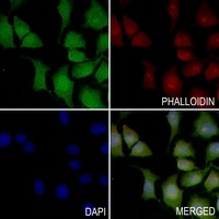 Anti-GNG12 Antibody