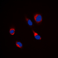 Anti-Beta-tubulin Antibody