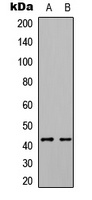 ABHD7 Rabbit Polyclonal Antibody