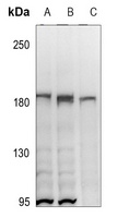 HER2 Rabbit Polyclonal Antibody
