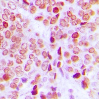 Anti-PE2 (Phospho-T526) Antibody