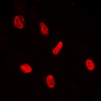 Anti-PE2 (Phospho-T526) Antibody