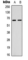 Estrogen Receptor alpha Rabbit Polyclonal Antibody