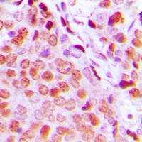 Anti-Estrogen Receptor alpha Antibody