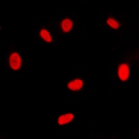 Anti-Estrogen Receptor alpha Antibody