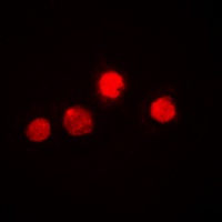 Anti-ETS1 Antibody