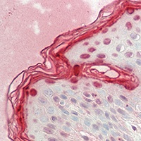 Filaggrin Antibody