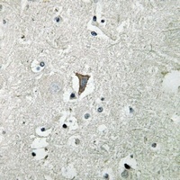 Anti-VEGFR1 Antibody