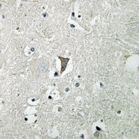 FLT1 antibody