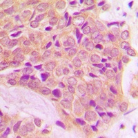 Anti-GAB1 Antibody