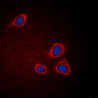 Anti-GAB1 Antibody