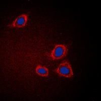 GAB1 antibody