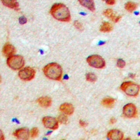 Anti-GAS6 Antibody