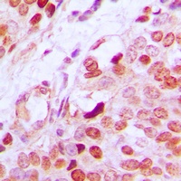 GATA1 (Phospho-S142) antibody